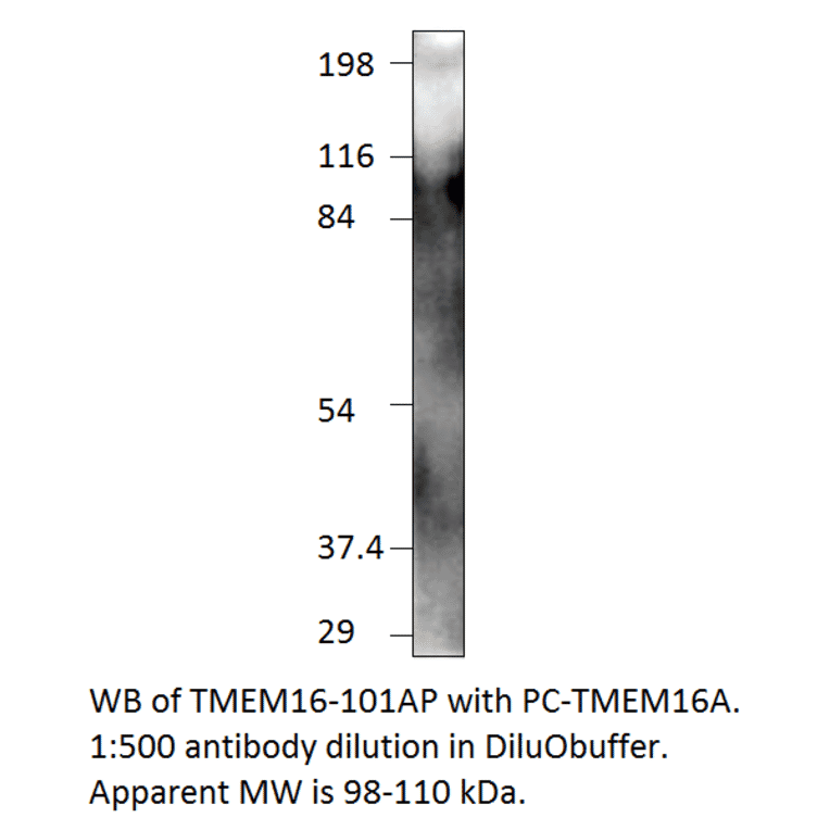 Anti-TMEM16A Antibody from FabGennix (TMEM16-101AP) - Antibodies.com