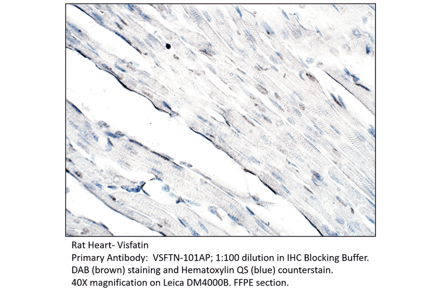 Anti-Visfatin Antibody from FabGennix (VSFTN-101AP) - Antibodies.com