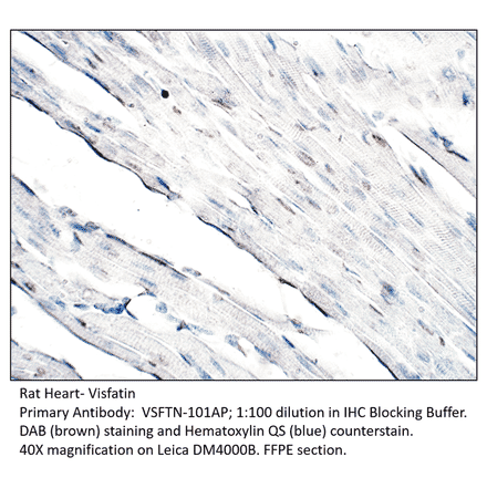 Anti-Visfatin Antibody from FabGennix (VSFTN-101AP) - Antibodies.com