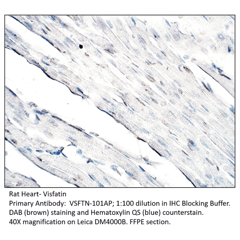 Anti-Visfatin Antibody from FabGennix (VSFTN-101AP) - Antibodies.com