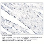 Anti-Visfatin Antibody from FabGennix (VSFTN-101AP) - Antibodies.com