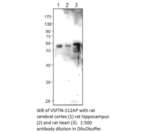 Anti-Visfatin Antibody from FabGennix (VSFTN-112AP) - Antibodies.com