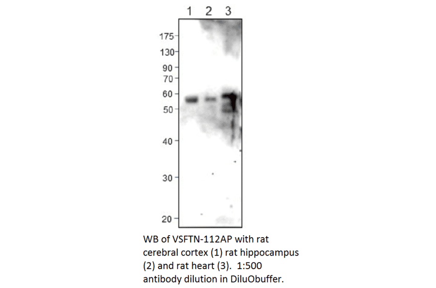 Anti-Visfatin Antibody from FabGennix (VSFTN-112AP) - Antibodies.com