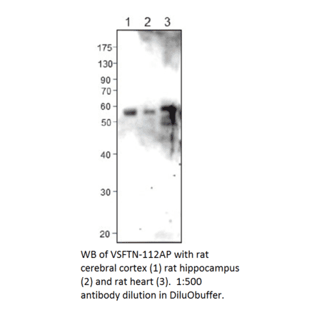 Anti-Visfatin Antibody from FabGennix (VSFTN-112AP) - Antibodies.com