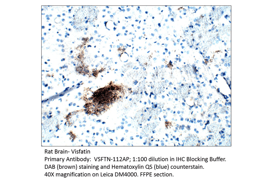 Anti-Visfatin Antibody from FabGennix (VSFTN-112AP) - Antibodies.com