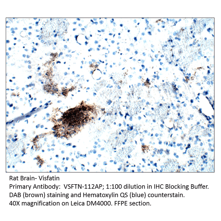 Anti-Visfatin Antibody from FabGennix (VSFTN-112AP) - Antibodies.com