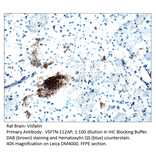 Anti-Visfatin Antibody from FabGennix (VSFTN-112AP) - Antibodies.com