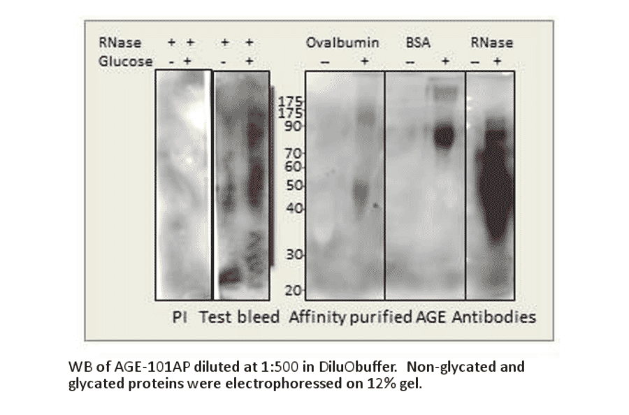 Anti-AGE Antibody (FITC) from FabGennix (AGE-FITC) - Antibodies.com