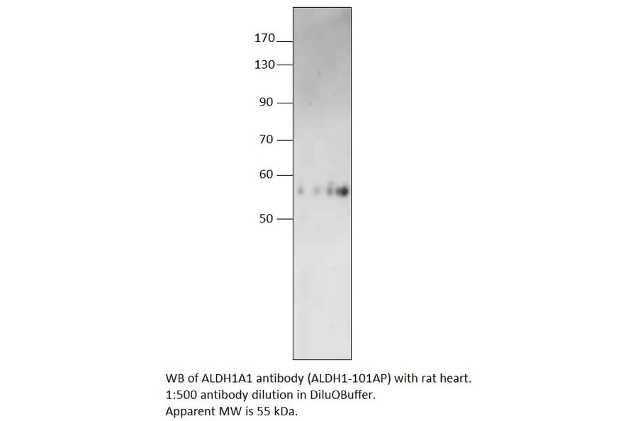Anti-ALDH1A1 Antibody from FabGennix (ALDH1-101AP) - Antibodies.com