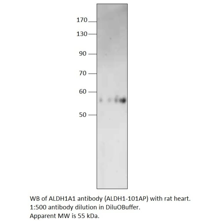 Anti-ALDH1A1 Antibody from FabGennix (ALDH1-101AP) - Antibodies.com