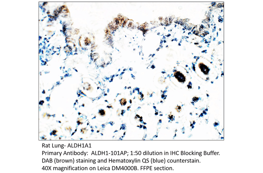 Anti-ALDH1A1 Antibody from FabGennix (ALDH1-101AP) - Antibodies.com