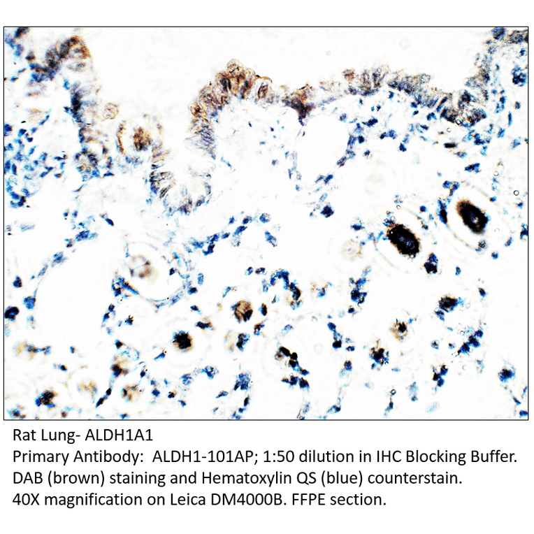 Anti-ALDH1A1 Antibody from FabGennix (ALDH1-101AP) - Antibodies.com