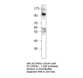 Anti-GPIP137 Antibody from FabGennix (CPRN1-101AP) - Antibodies.com