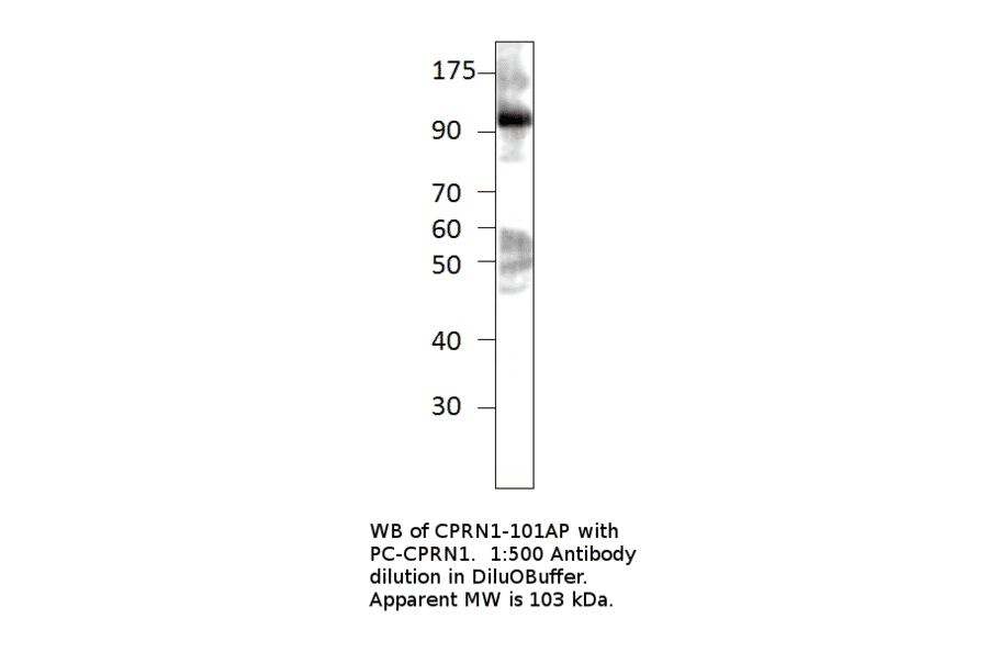 Anti-GPIP137 Antibody from FabGennix (CPRN1-101AP) - Antibodies.com