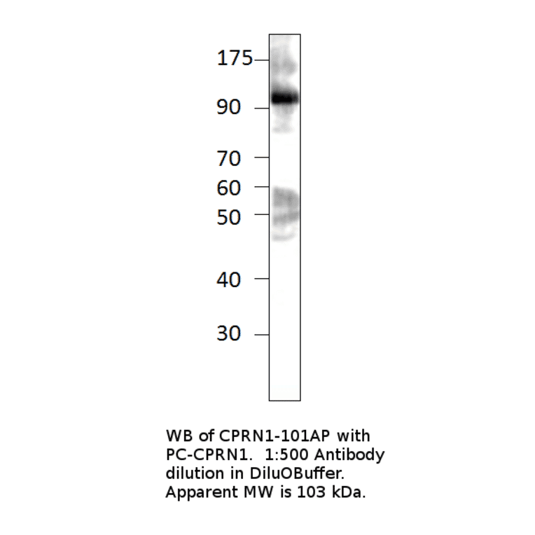 Anti-GPIP137 Antibody from FabGennix (CPRN1-101AP) - Antibodies.com