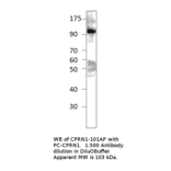 Anti-GPIP137 Antibody from FabGennix (CPRN1-101AP) - Antibodies.com