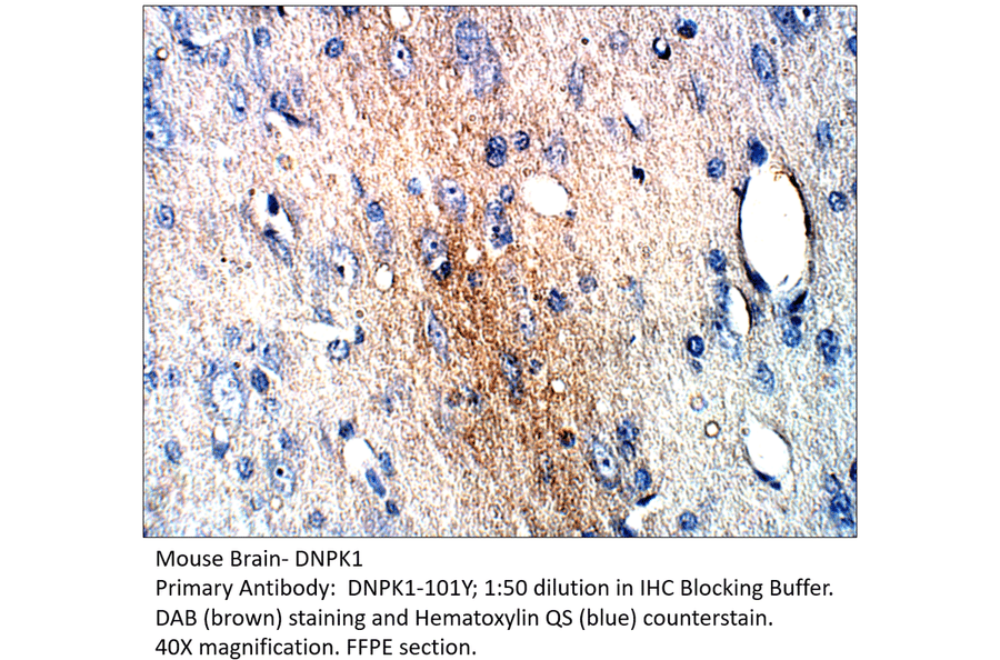 Anti-DNA PKcs Antibody from FabGennix (DNPK1-101Y) - Antibodies.com