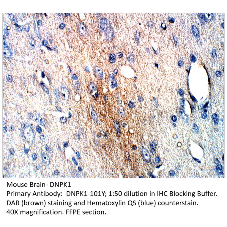 Anti-DNA PKcs Antibody from FabGennix (DNPK1-101Y) - Antibodies.com