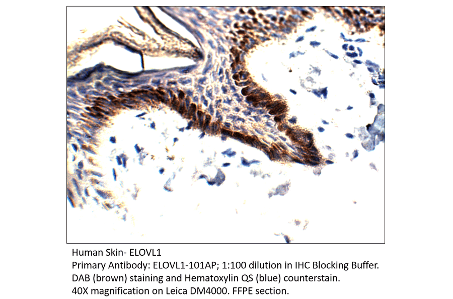 Anti-ELOVL1 Antibody from FabGennix (ELOVL1-101AP) - Antibodies.com