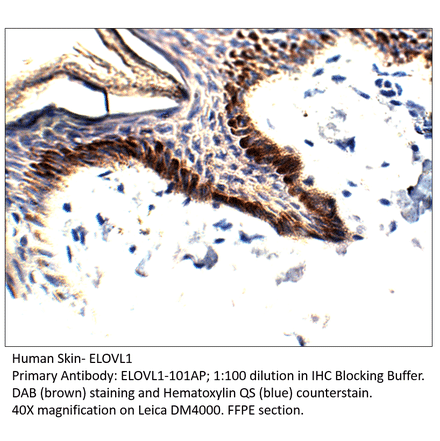 Anti-ELOVL1 Antibody from FabGennix (ELOVL1-101AP) - Antibodies.com