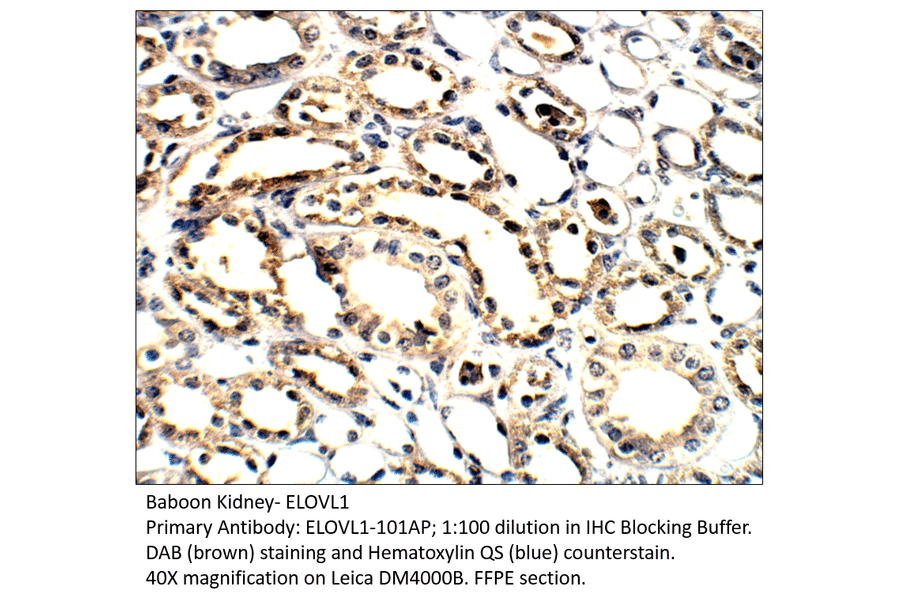 Anti-ELOVL1 Antibody from FabGennix (ELOVL1-101AP) - Antibodies.com