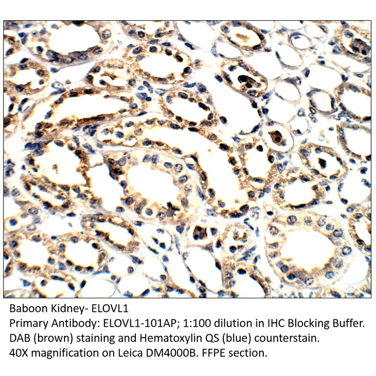 Anti-ELOVL1 Antibody from FabGennix (ELOVL1-101AP) - Antibodies.com