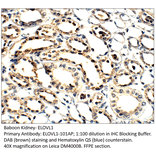 Anti-ELOVL1 Antibody from FabGennix (ELOVL1-101AP) - Antibodies.com