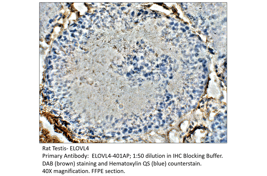 Anti-ELOVL4 Antibody from FabGennix (ELOVL4-401AP) - Antibodies.com