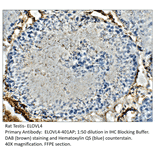 Anti-ELOVL4 Antibody from FabGennix (ELOVL4-401AP) - Antibodies.com