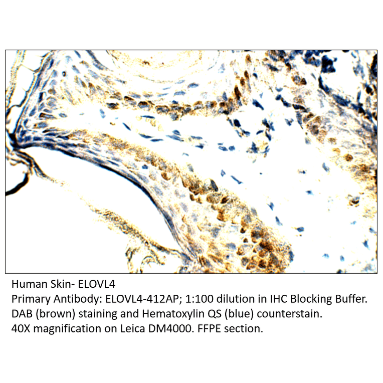 Anti-ELOVL4 Antibody from FabGennix (ELOVL4-412AP) - Antibodies.com