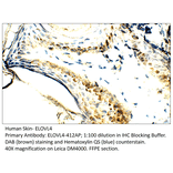 Anti-ELOVL4 Antibody from FabGennix (ELOVL4-412AP) - Antibodies.com