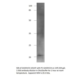 Anti-DDIT3 Antibody from FabGennix (GADD153-101AP) - Antibodies.com