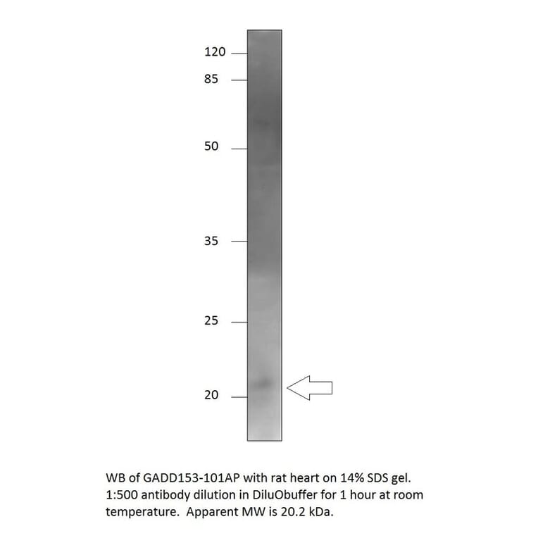 Anti-DDIT3 Antibody from FabGennix (GADD153-101AP) - Antibodies.com