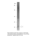 Anti-DDIT3 Antibody from FabGennix (GADD153-101AP) - Antibodies.com