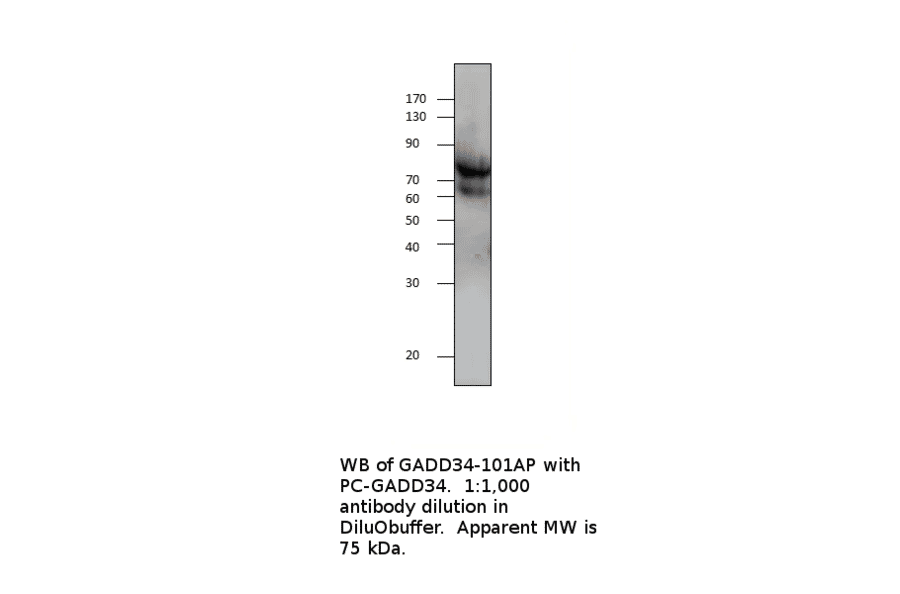 Anti-GADD34 Antibody from FabGennix (GADD34-101AP) - Antibodies.com