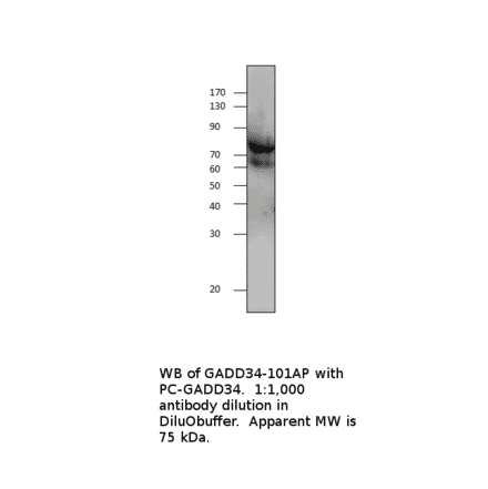 Anti-GADD34 Antibody from FabGennix (GADD34-101AP) - Antibodies.com