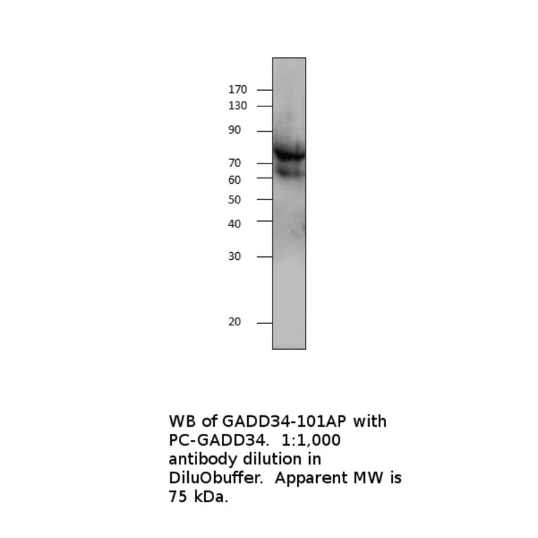 Anti-GADD34 Antibody from FabGennix (GADD34-101AP) - Antibodies.com