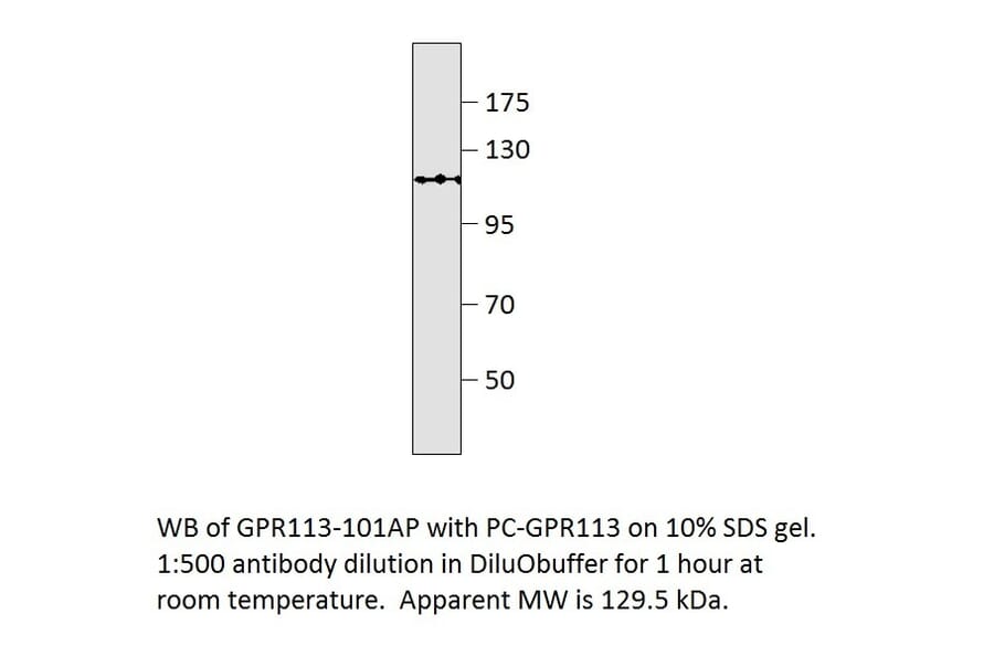 Anti-GPR113 Antibody from FabGennix (GPR113-101AP) - Antibodies.com