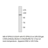 Anti-GPR113 Antibody from FabGennix (GPR113-101AP) - Antibodies.com