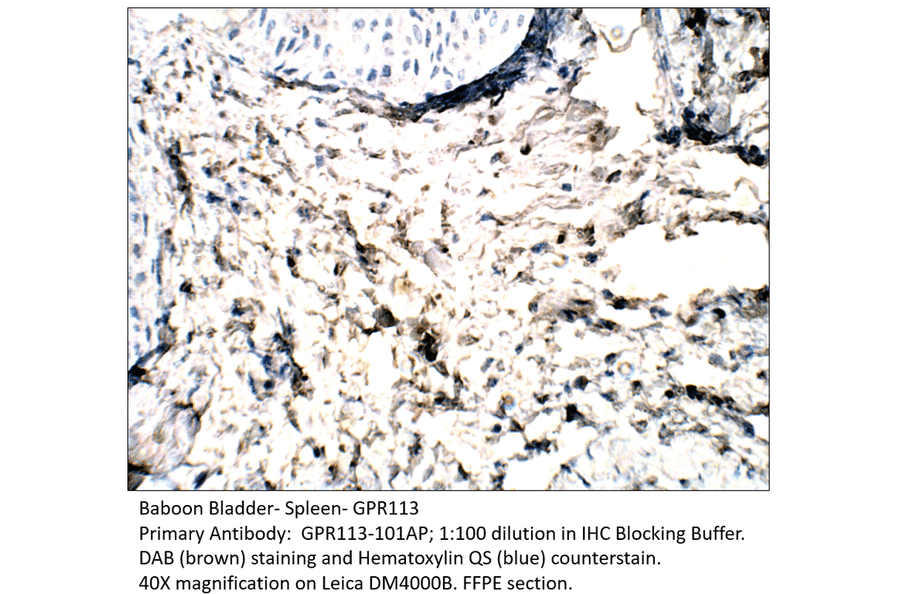 Anti-GPR113 Antibody from FabGennix (GPR113-101AP) - Antibodies.com