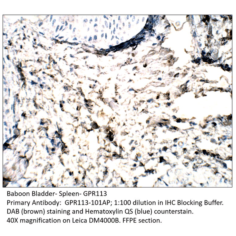 Anti-GPR113 Antibody from FabGennix (GPR113-101AP) - Antibodies.com
