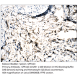 Anti-GPR113 Antibody from FabGennix (GPR113-101AP) - Antibodies.com