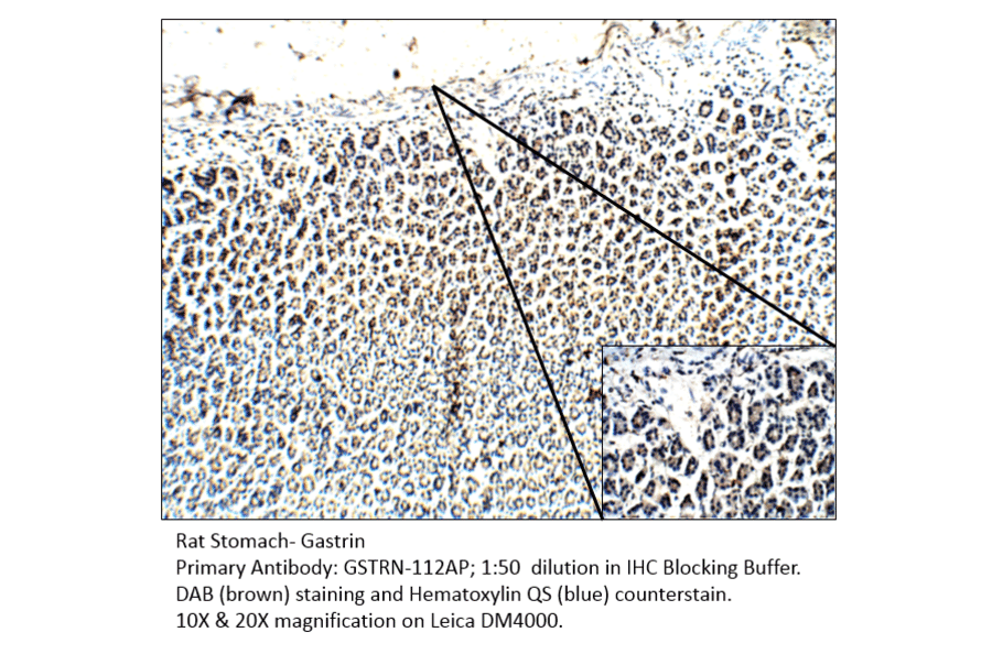 Anti-Gastrin Antibody from FabGennix (GSTRN-112AP) - Antibodies.com