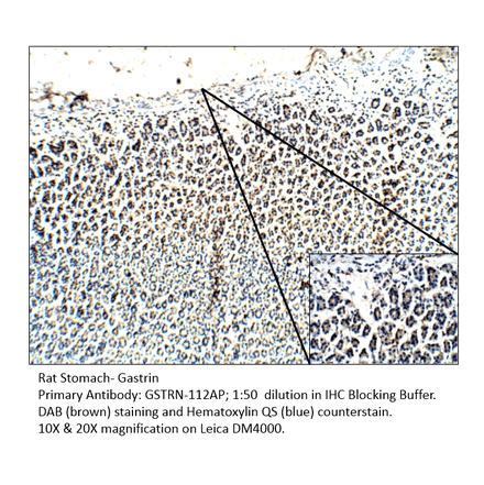 Anti-Gastrin Antibody from FabGennix (GSTRN-112AP) - Antibodies.com