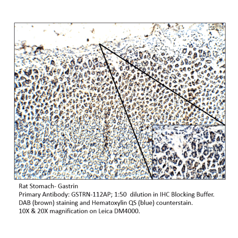 Anti-Gastrin Antibody from FabGennix (GSTRN-112AP) - Antibodies.com