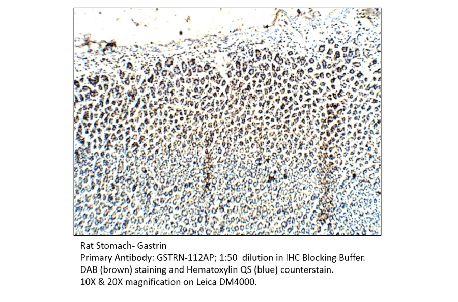 Anti-Gastrin Antibody from FabGennix (GSTRN-112AP) - Antibodies.com