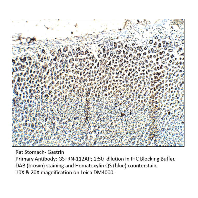 Anti-Gastrin Antibody from FabGennix (GSTRN-112AP) - Antibodies.com