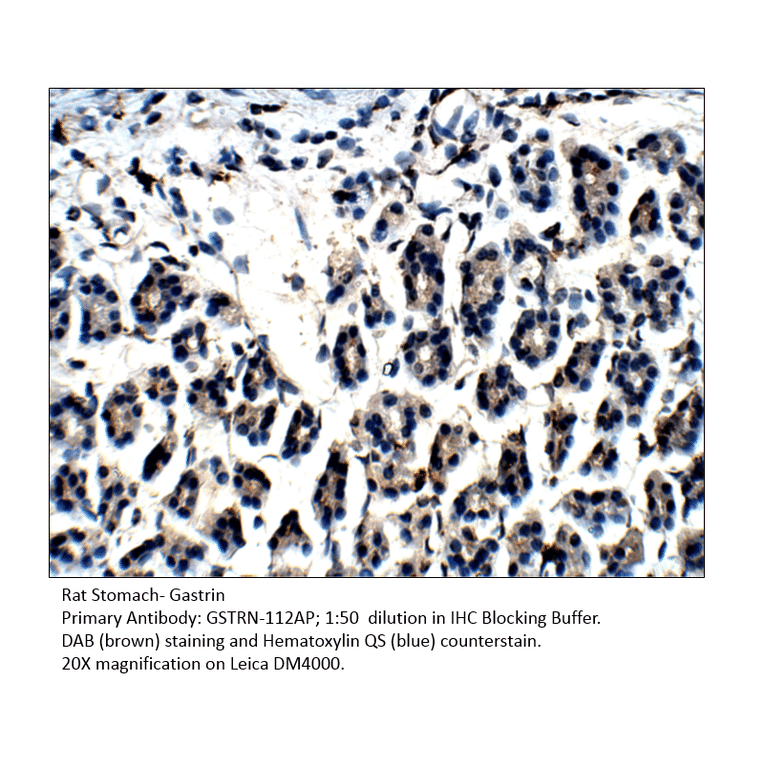Anti-Gastrin Antibody from FabGennix (GSTRN-112AP) - Antibodies.com