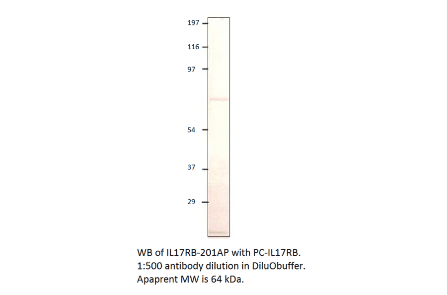 Anti-IL17RB Antibody from FabGennix (IL17RB-201AP) - Antibodies.com
