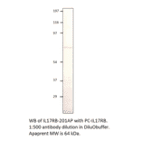 Anti-IL17RB Antibody from FabGennix (IL17RB-201AP) - Antibodies.com